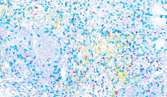 What steps to follow when developing multiplex IHC assays