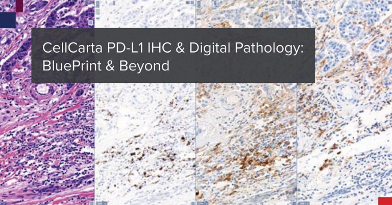 PD-L1 IHC and Digital Pathology: Insights and Future Directions | CellCarta