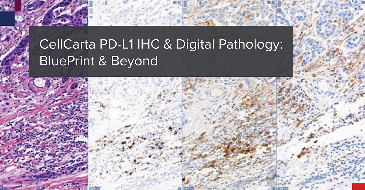 PD-L1 IHC & Digital Pathology: BluePrint & Beyond