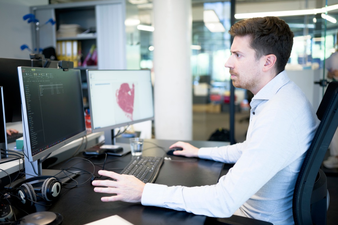 Data reporting and analysis at CellCarta