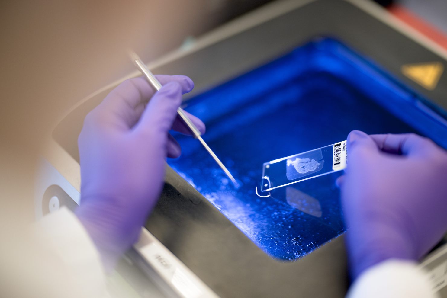 Gloved hands staining slides in a tray.