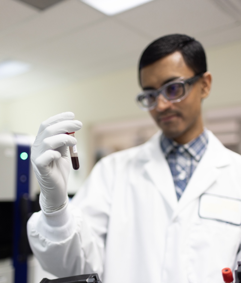 Alzheimer’s Disease CSF biomarker assays