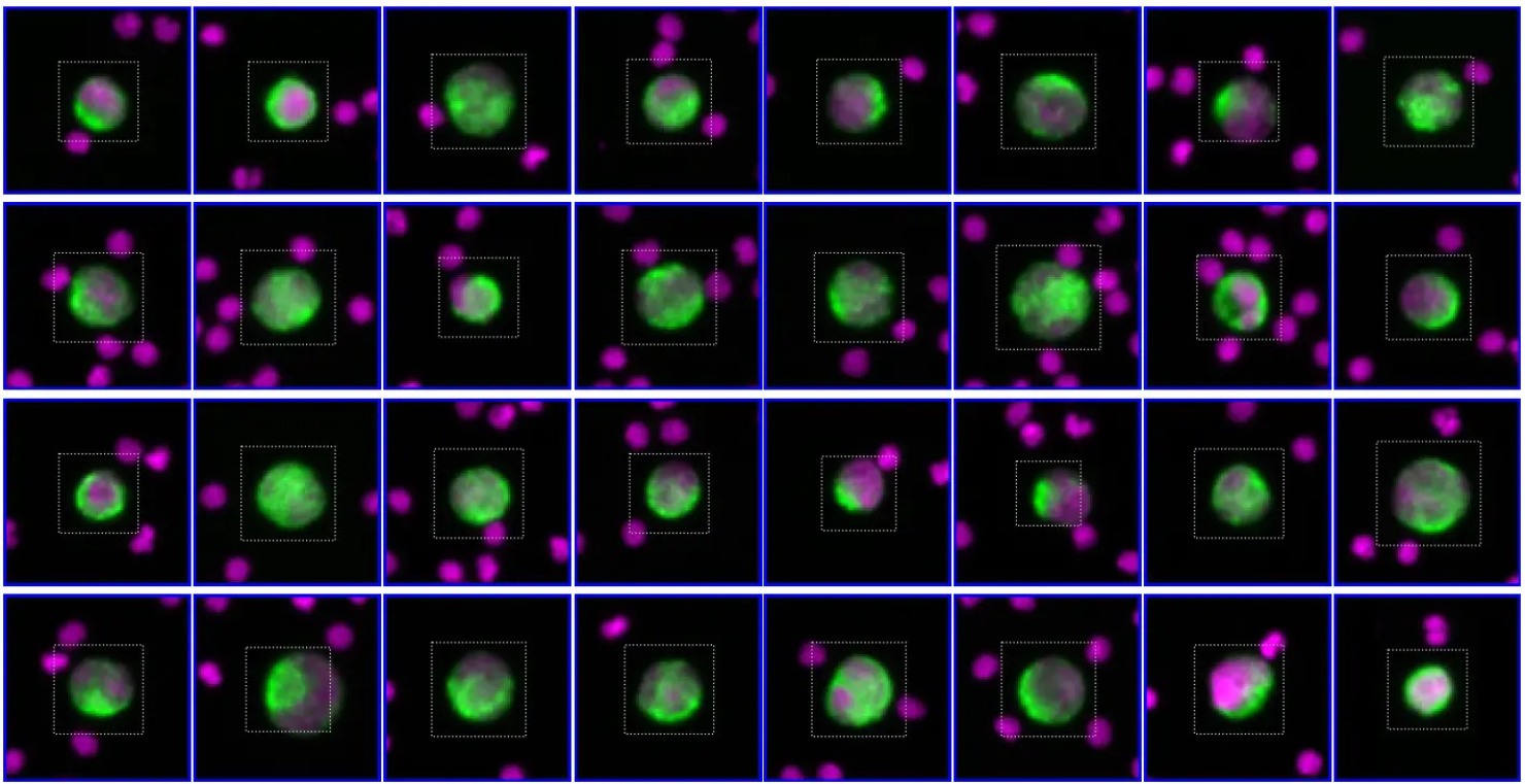 Fluorescence-stained cells imaged on the RareCyte platform.